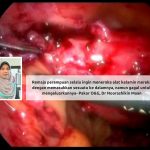 emaja perempuan atau wanita yang ingin meneroka alat kelamin mereka dengan memasukkan sesuatu ke dalamnya, namun gagal untuk mengeluarkannya,