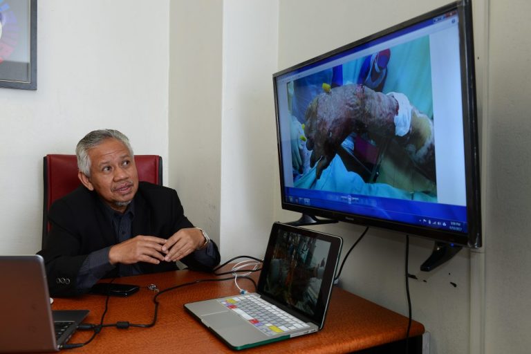 Mati Atau Cacat Kekal Di Tempat Kerja, Ini Cara Failkan Saman Jika Majikan Cuai
