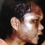 nirmala bonat