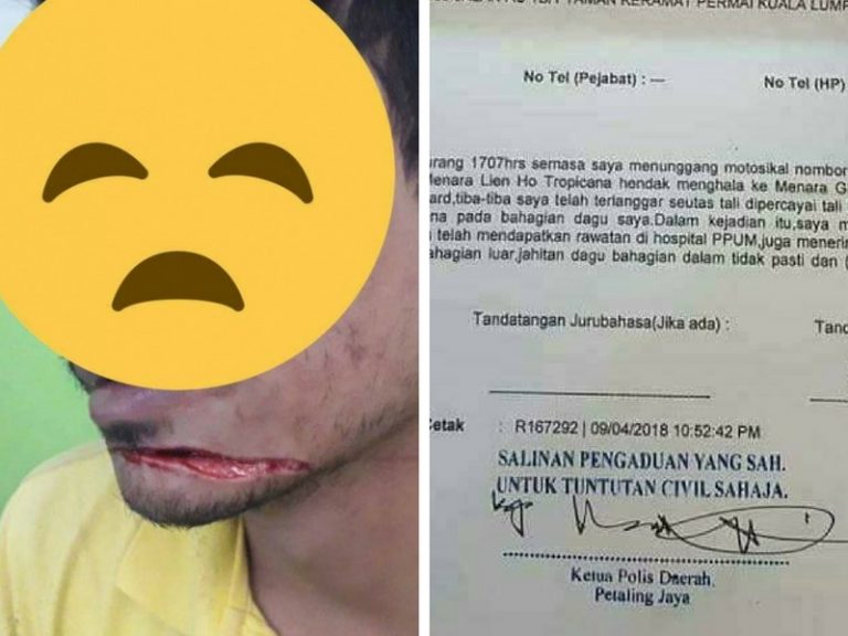 Tular Muka Brader Ini Terbelah & Terima 25 Jahitan Selepas Terlanggar Tali Tangsi Di Lebuhraya SPRINT