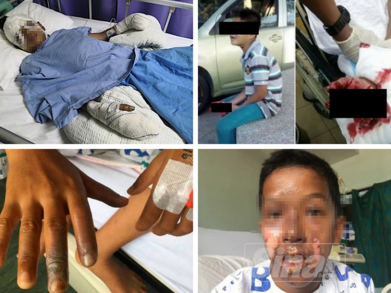 Ini 7 Kes Main Mercun Paling Tragis Di Musim Raya, Ada Mati & Hilang Jari