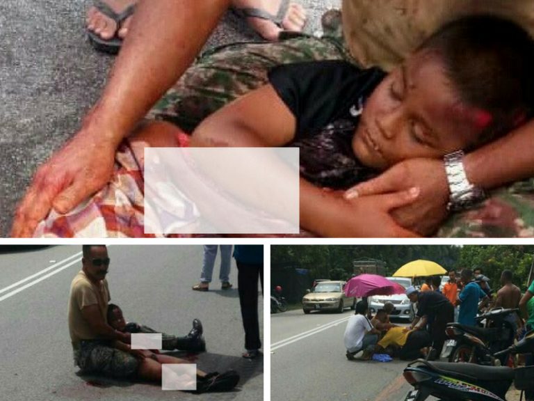 “Saya Sedih Melihatnya…”, Saksi Kongsi Pengalaman Selamatkan Budak Lelaki 8 Tahun Putus Kaki Digilis Lori