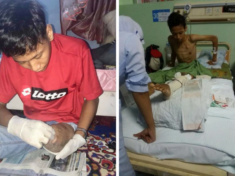 “Dulu Bersedia Hilang Kaki, Kini Redha Jika Nyawa Ditarik”, Pelajar SPM Hidap Kanser Luah Rasa Sedih