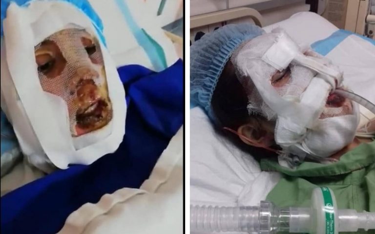 Ya Allah!Beginilah Keadaan Terkini Pelajar Mangsa Letupan Kedai Dobi Yang Korbankan Bapanya Di Klang