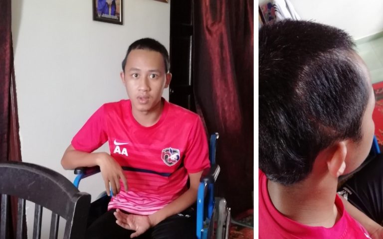 Remaja Aktif Bersukan Sehingga Mukanya Kebas, Tempurung Kepalanya Perlu Dibelah