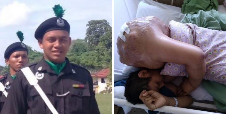 “Rileklah Ayah Jangan Menangis”, Pesakit Kanser Tulang Sempat Buka Oksigen Seolah Sihat Sebelum Meninggal