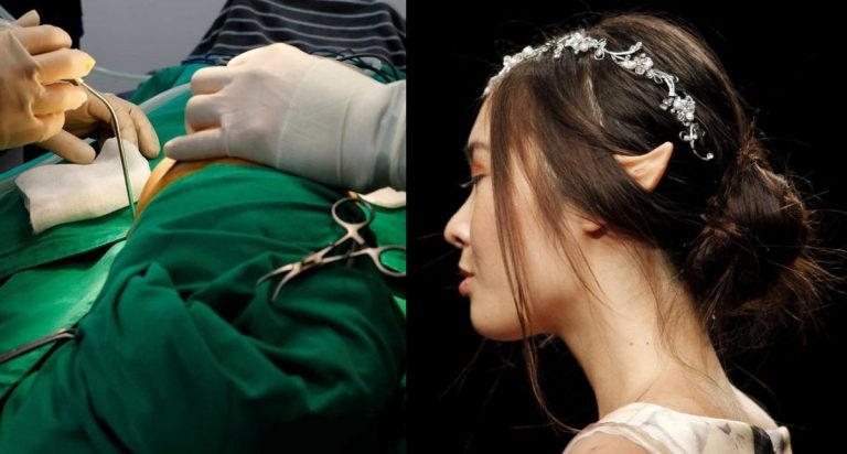 Telinga ‘Elf’ Cara Pantas Buat Wajah Lebih Langsing Dan Muda, Trend Remaja Di China