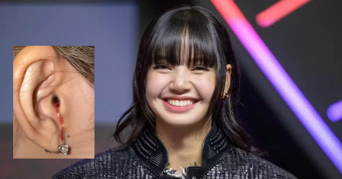 “Agak Sakit, Tapi Dah Jumpa Doktor” Lisa BLACKPINK Tenangkan BLINK Lepas Insiden Telinga Berdarah Tular