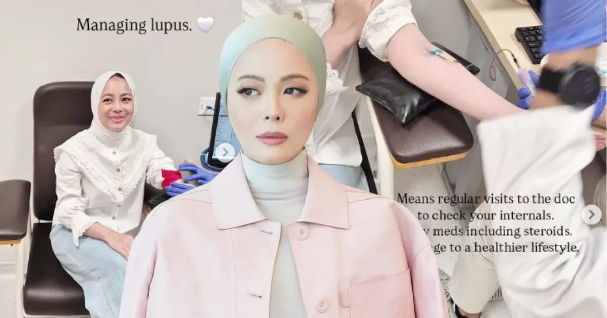 Vivy Yusof Akui Reda Hidap Penyakit Lupus, 'Stres Itu Musuh Paling Bahaya...'