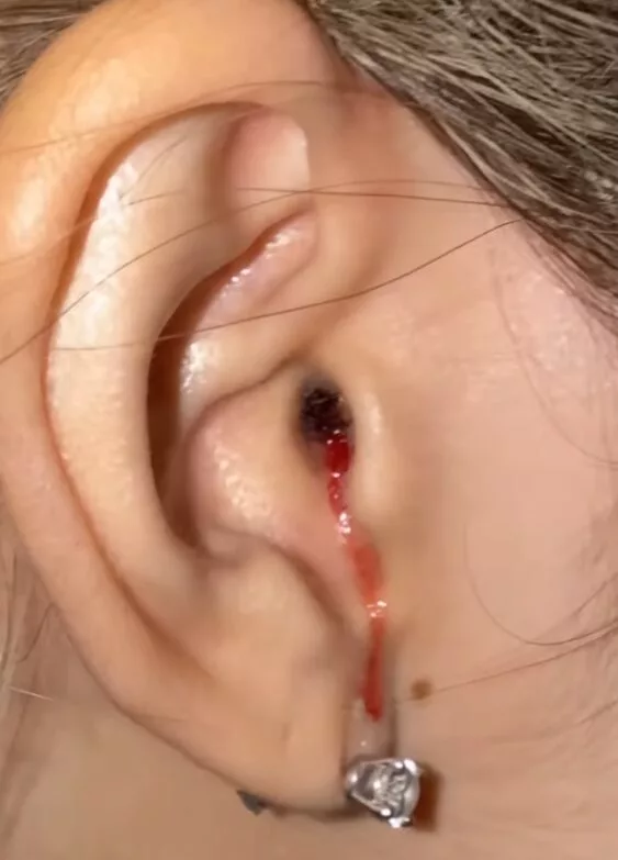 “Agak Sakit, Tapi Dah Jumpa Doktor” Lisa BLACKPINK Tenangkan BLINK Lepas Insiden Telinga Berdarah Tular