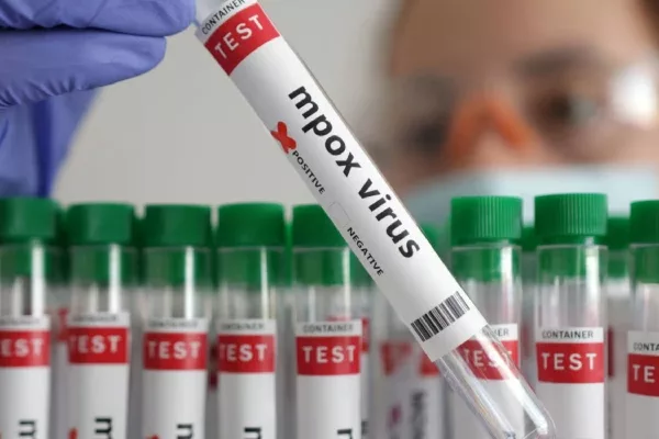 Mpox Malaysia: Kluster Baharu Cetus Amaran Penting Daripada KKM