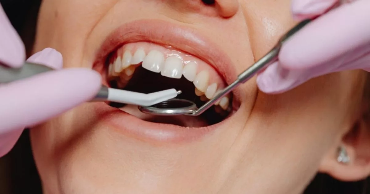 Floss Gigi: Bahaya Sebenar Yang Ramai Abaikan & Risiko Serangan Jantung 6 Floss Gigi: Bahaya Sebenar Yang Ramai Abaikan & Risiko Serangan Jantung