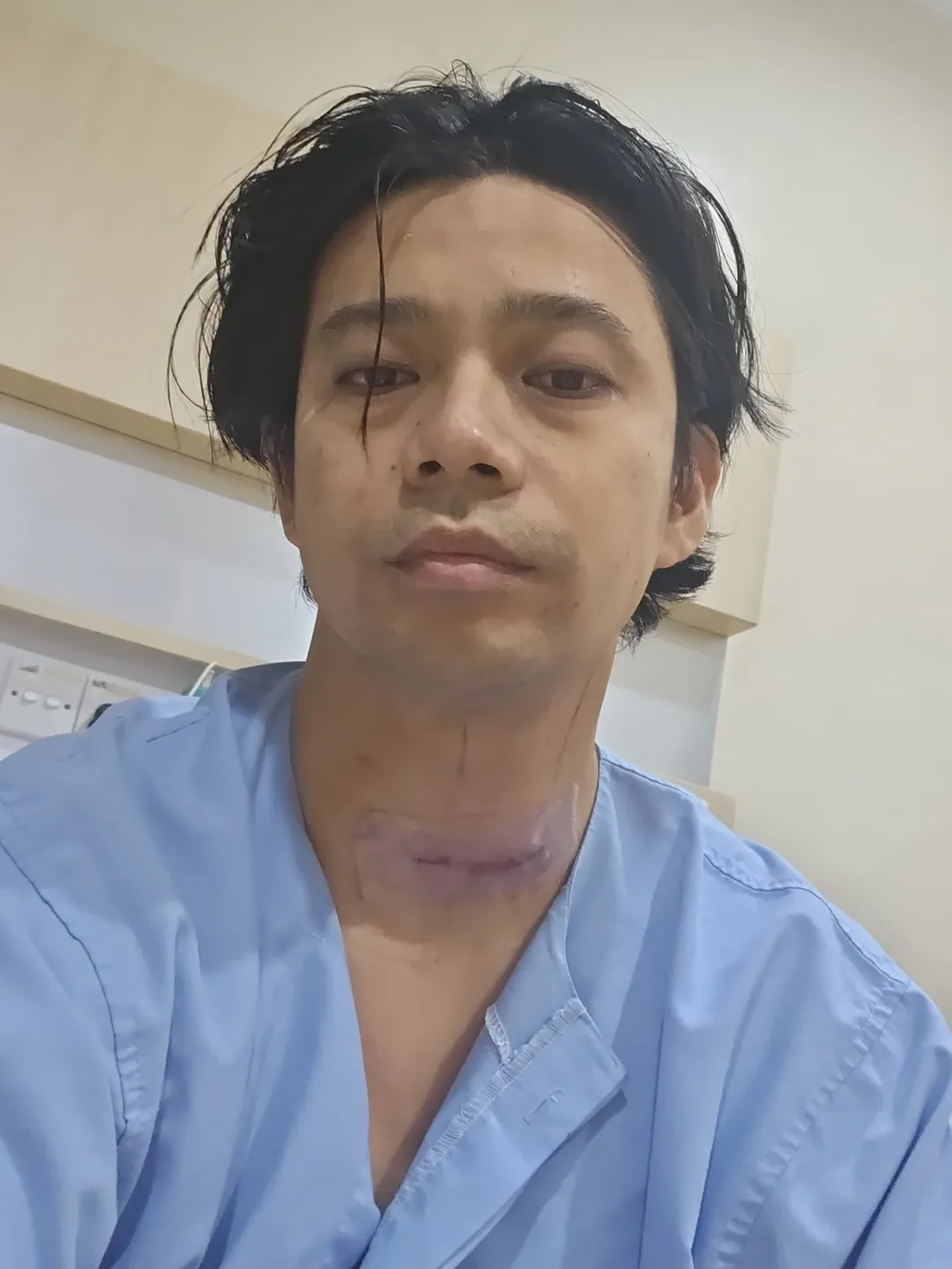 Noh Salleh Selamat Jalani Pembedahan, Luah Risiko Dekat Pita Suara Undang Kebimbangan