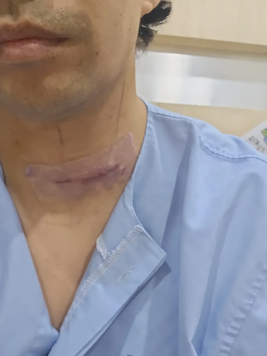 Noh Salleh Selamat Jalani Pembedahan, Luah Risiko Dekat Pita Suara Undang Kebimbangan