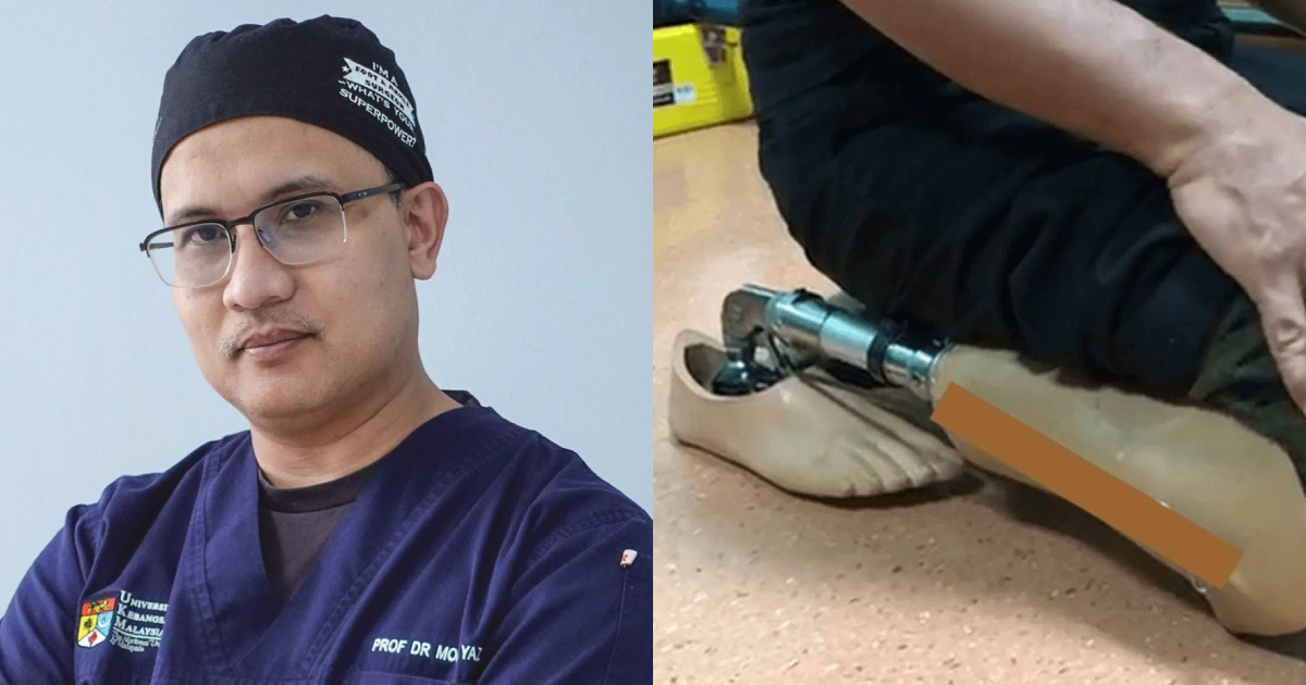 Pakar Ortopedik HUKM Hasilkan Kaki Palsu Mesra Solat Pertama Dunia, Beri Harapan Baru Buat Pesakit Amputasi