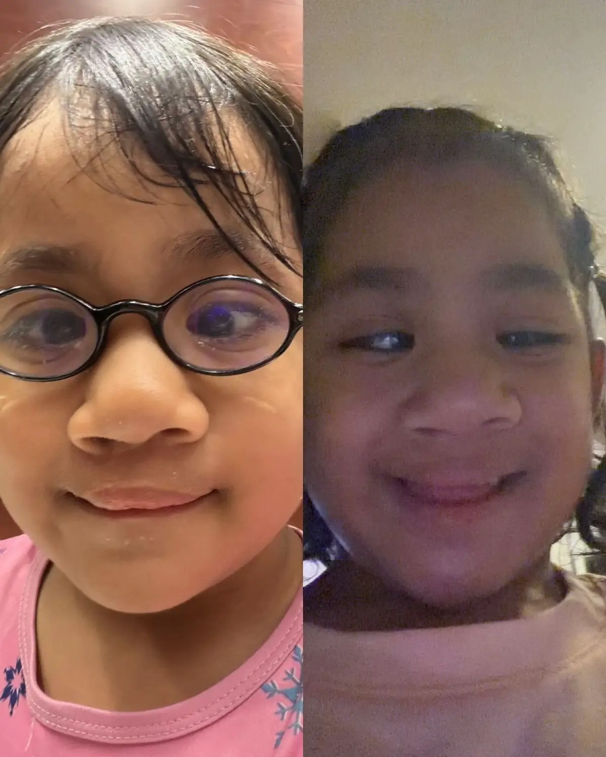 “Kecil-Kecil Dah Banyak Ujian, Kuat Sangat Alisha” -Andika Putera Kongsi Perkembangan Terkini Mata Anak Selepas Pembedahan 10 “Kecil-Kecil Dah Banyak Ujian, Kuat Sangat Alisha” -Andika Putera Kongsi Perkembangan Terkini Mata Anak Selepas Pembedahan
