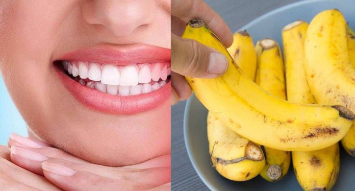Putihkan Gigi Kekuningan Dengan Kulit Pisang, Seriuslah 